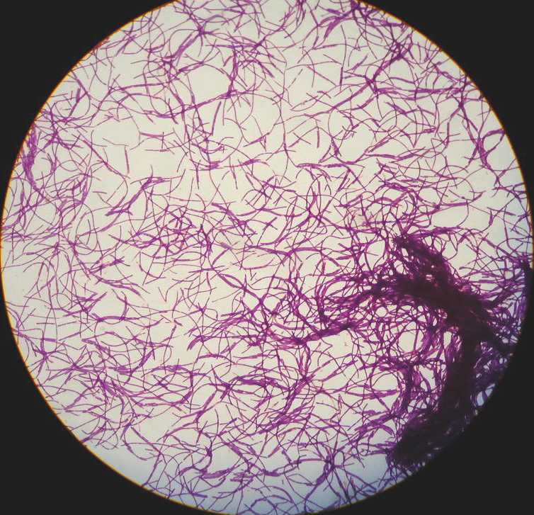 Микропрепарат бактерий. Bacillus subtilis микроскопия. Сенная палочка микроскопия. Штамм Bacillus subtilis колония. Bacillus subtilis грамположительные.
